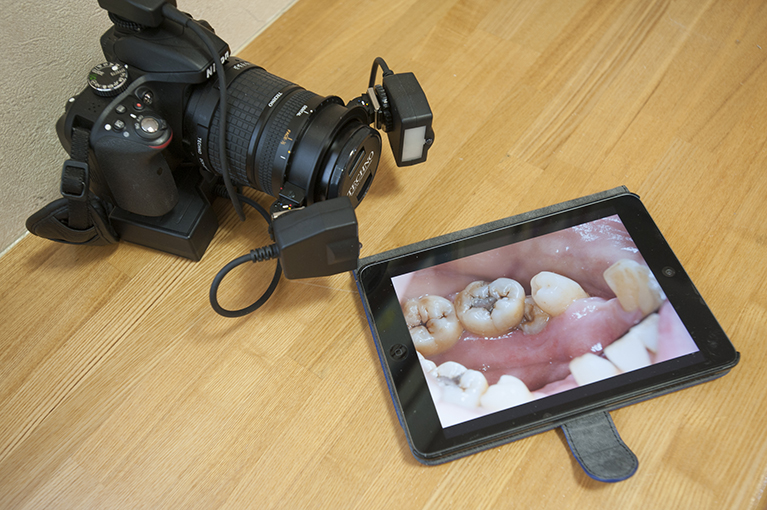 iPadと口腔用カメラ
