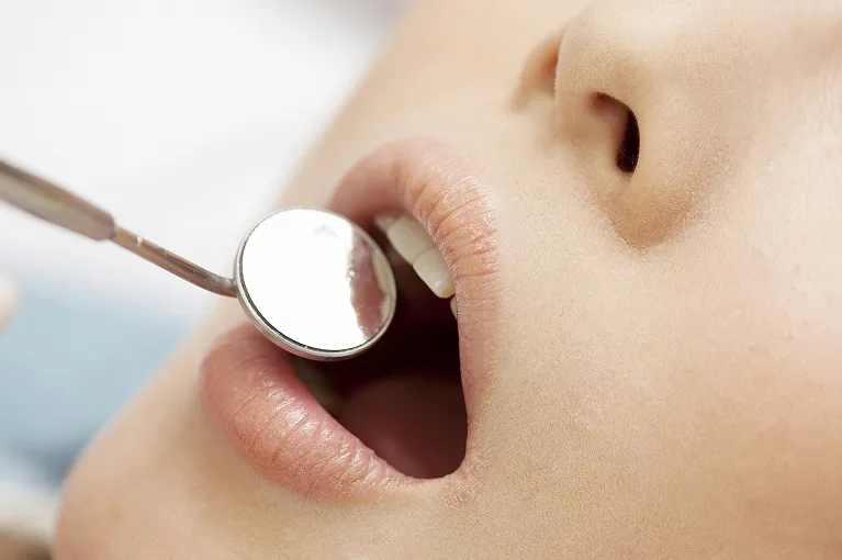 インプラントが骨と結合するのを待つ期間